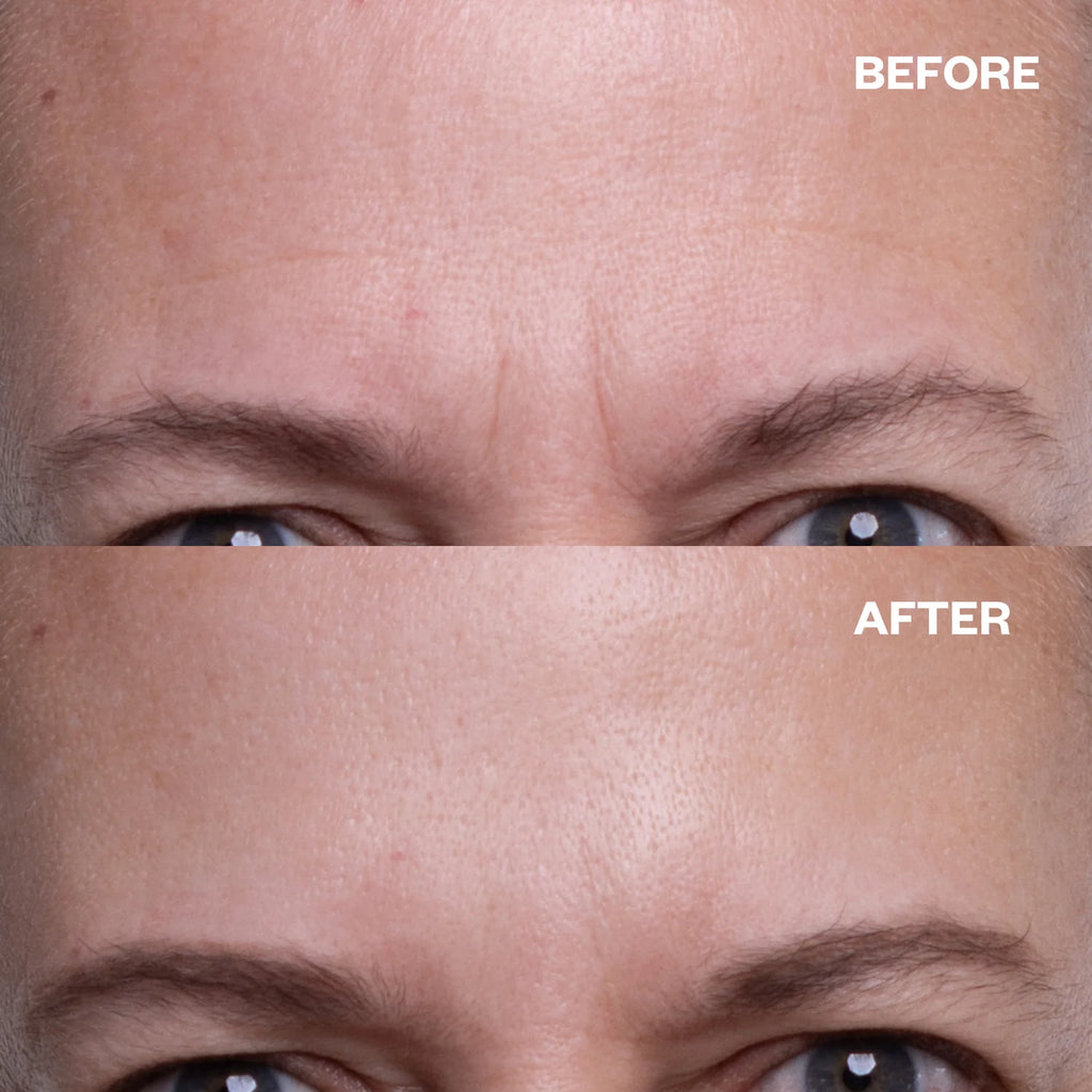 Wrinkles Schminkles Reusable Forehead Wrinkle Patch