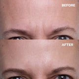 Wrinkles Schminkles Reusable Forehead Wrinkle Patch